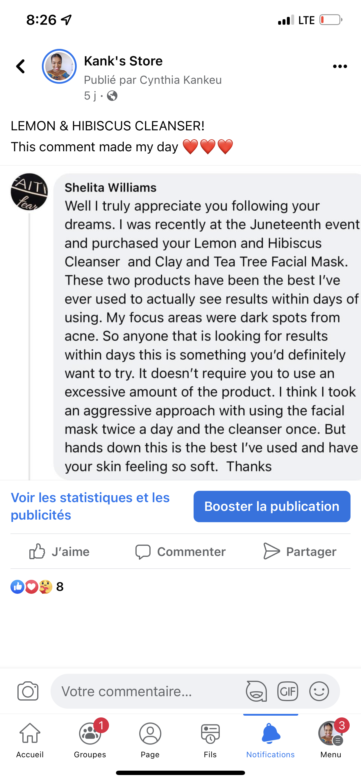 Hyperpigmentation- DARK SPOTS