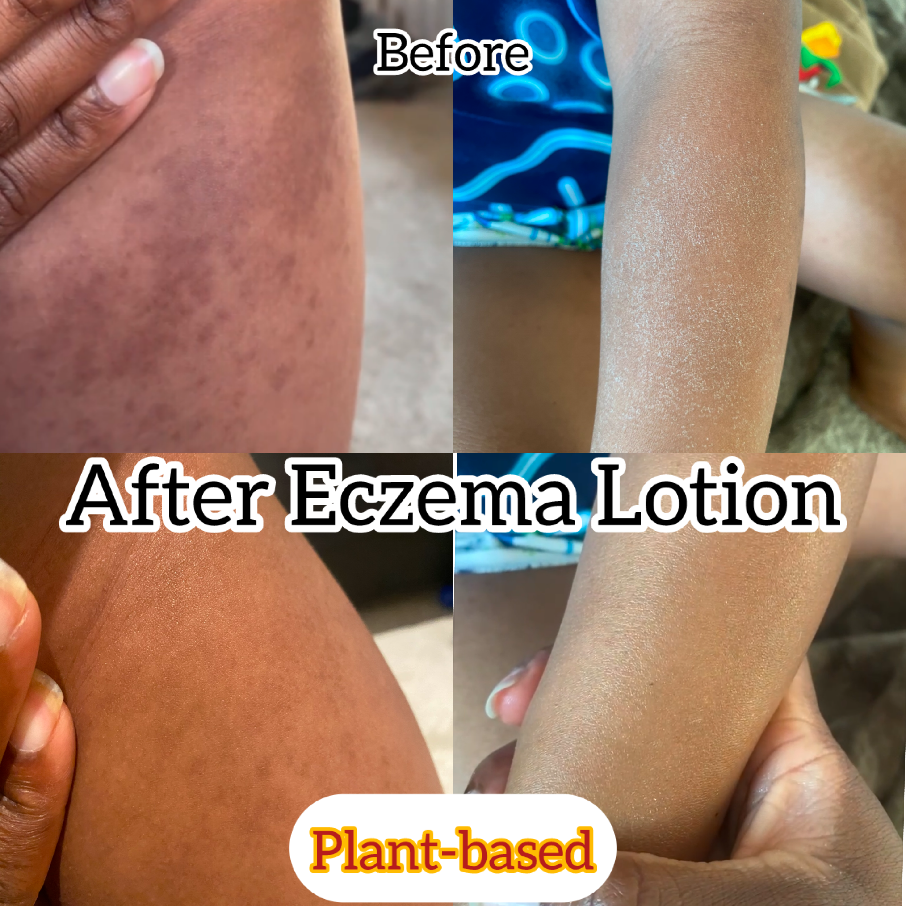 Eczema Relief - Spirulina Lotion | Plant-based formula with plantain leaf